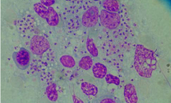 Leishmania braziliensis Complex, Leishmania mexicana Complex
